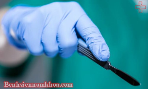 Cắt bao quy đầu ở phòng khám nào?