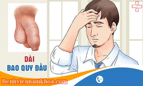 Dài bao quy đầu và những điều bạn cần biết