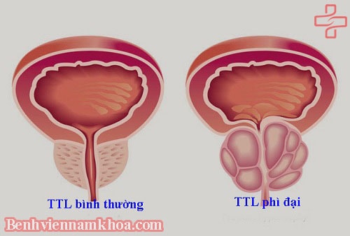 Bà bầu có được ăn ốc không?
