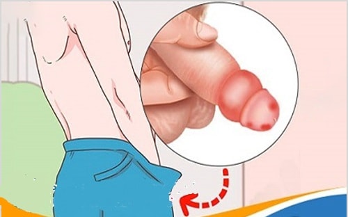 Hạ sốt nhanh, không phải lúc nào cũng đúng!