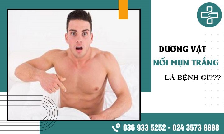 Dương vật nổi mụn trắng do viêm nhiễm hay bệnh xã hội? -1 số chia sẻ từ chuyên gia