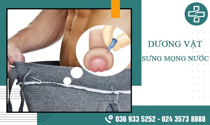 Dương vật sưng mọng nước: Điều trị ngay cùng Tiến sĩ hơn 40 năm kinh nghiệm