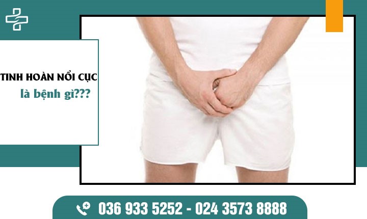 Tinh hoàn nổi cục – 1 Vài dấu hiệu bất thường cần thăm khám ngay