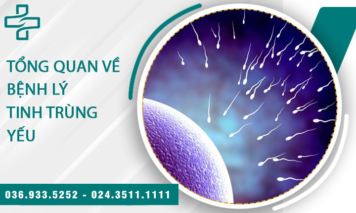 Tinh trùng yếu và 1 số điều nam giới cần nắm rõ