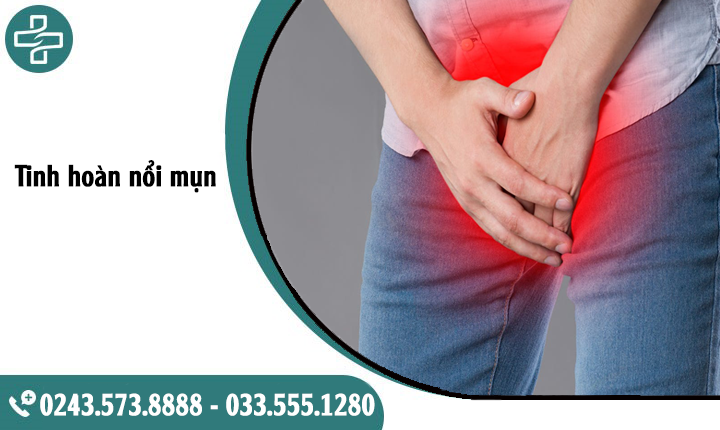 Tinh hoàn nổi mụn lạ: Cảnh báo nguy cơ bệnh sinh dục