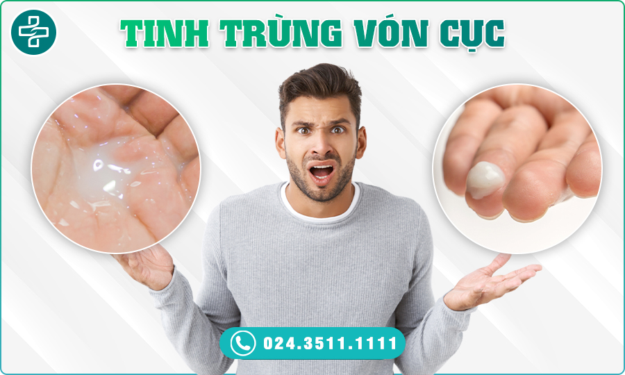 Tinh trùng vón cục có đáng lo không?