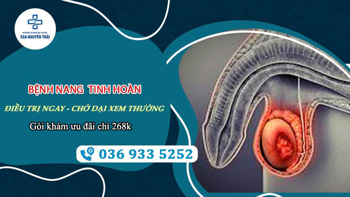 Bệnh nang tinh hoàn: Điều trị ngay – Chớ dại mà xem thường!