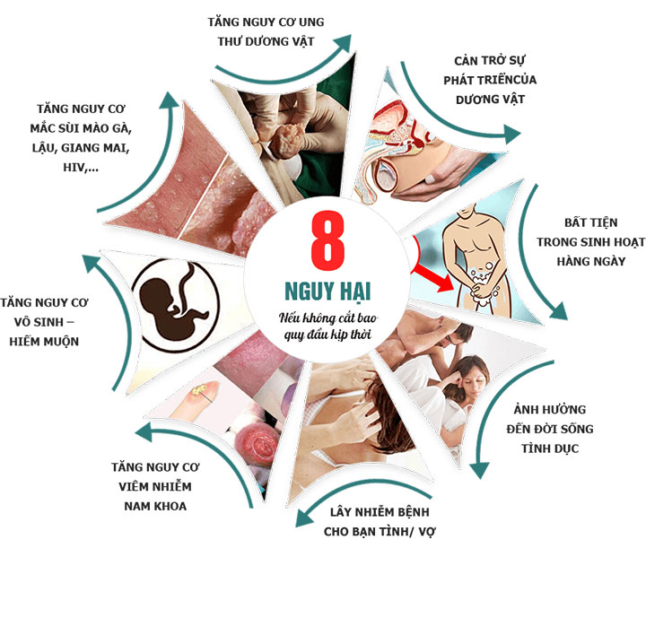 Địa chỉ cắt bao quy đầu uy tín, chất lượng cao ở Hà Nội