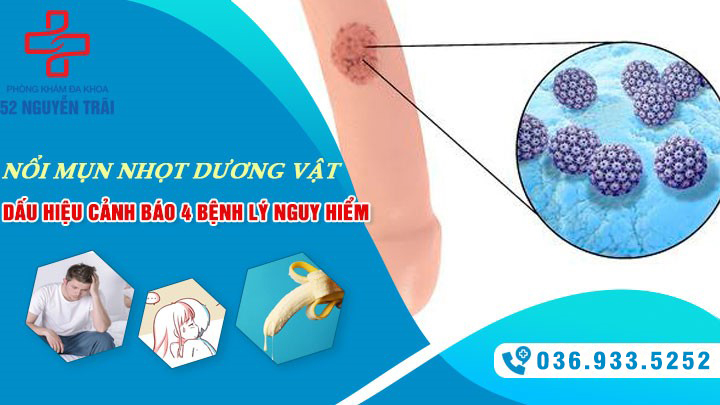 Dương vật có hạt nhỏ – Dấu hiệu của nhiều bệnh lý nguy hiểm
