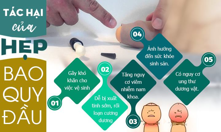 Các bệnh cậu nhỏ nam giới thường gặp nhất hiện nay & Cách khắc phục